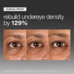 Dermalogica Smart Eye Density Serum